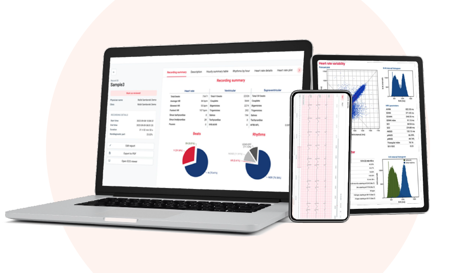 Cardiomatics – AI voor Holteranalyse